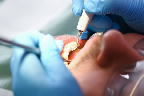 Best Emergency Orthodontic Repairs in Mccom, MS