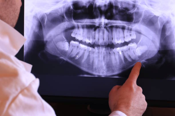 Best Broken or Chipped Tooth Repair in Mccom, MS