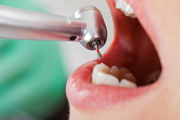 Best Walk-In Emergency Dental Services in Mccom, MS